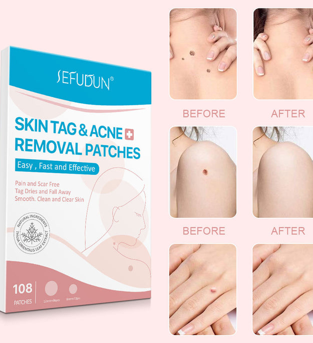 Acne Skin Tag Remover Beauty Acne Patch Wart Removal Stickers Removal Care Invisible Blackhead Skin Patch